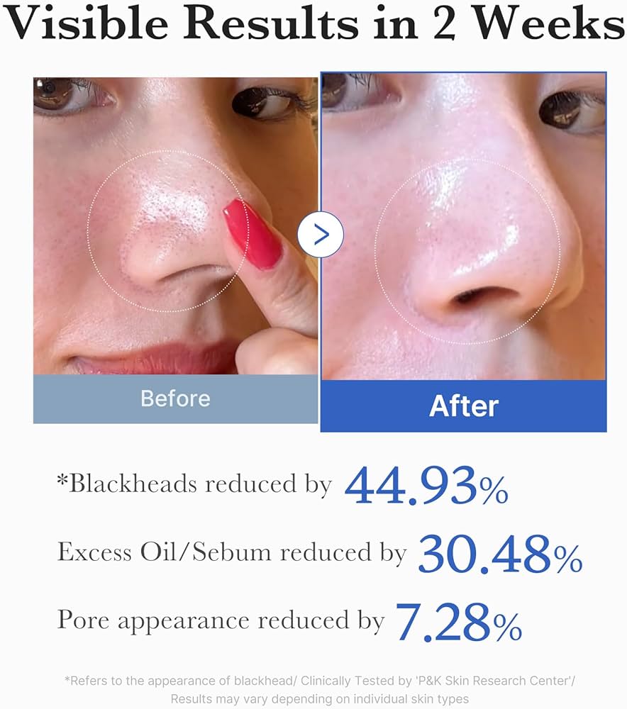 MEDICUBE Zero Pore Pad 2.0 (70 Pads / 155 g)
Dual-Textured Facial Pad with 4.5% AHA Lactic Acid, 0.45% BHA Salicylic Acid