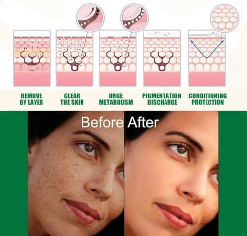 Dark Spot Correcting Glow Serum And Hoygi Niacinamide 10%+TXA 4% Serum