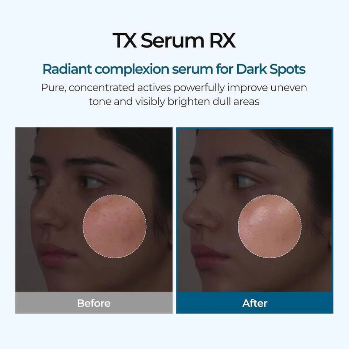 Dr.Melaxin TX Brightening Pigmentation Ampoule
(30ml)