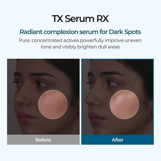 Dr.Melaxin TX Brightening Pigmentation Ampoule
(30ml)