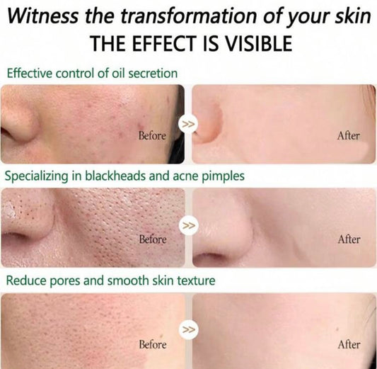 AXIS-Y
Artichoke Intensive Skin Barrier Ampoule