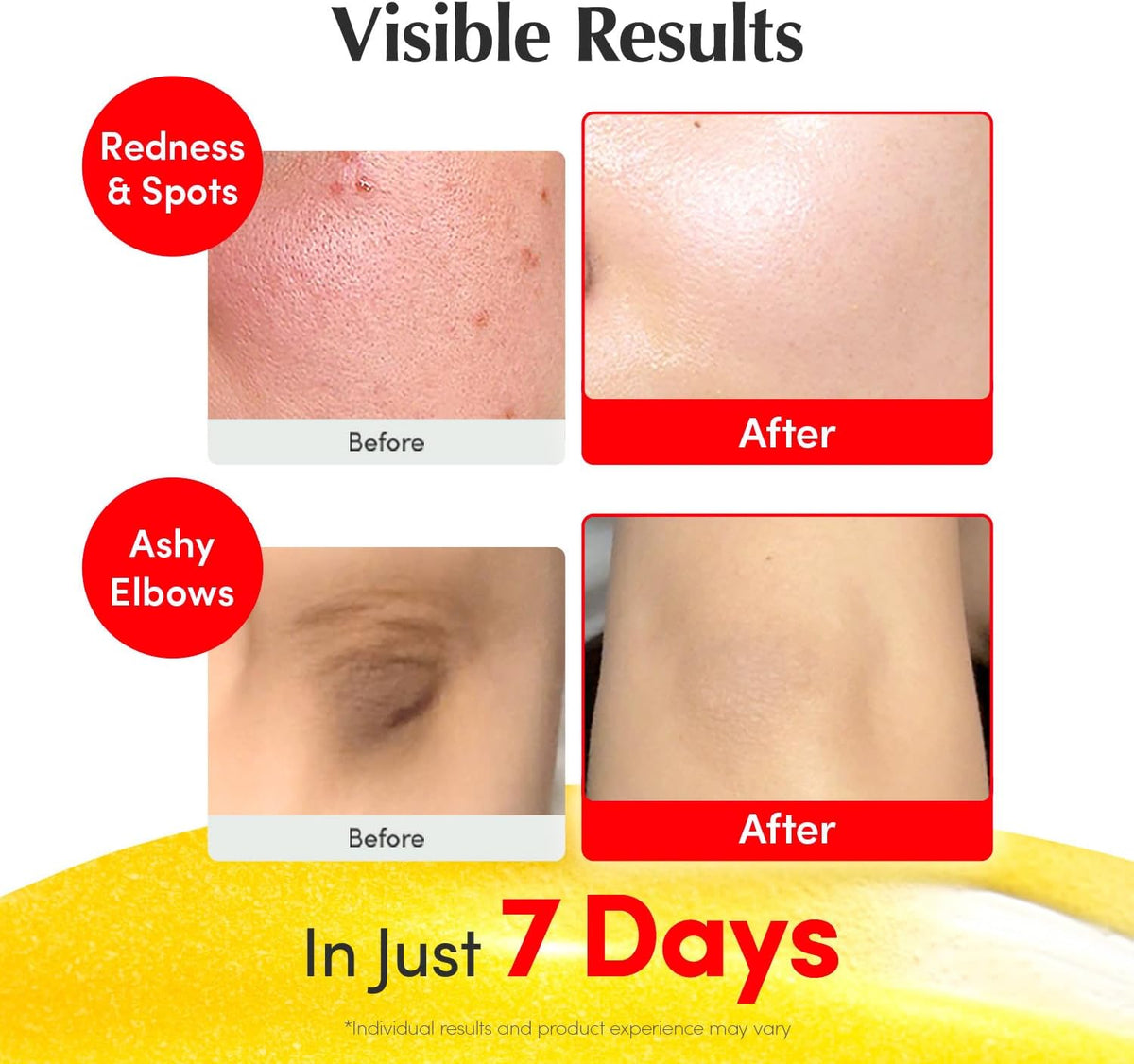 EQQUALBERRY Vitamin C Brightening Serum 30ml