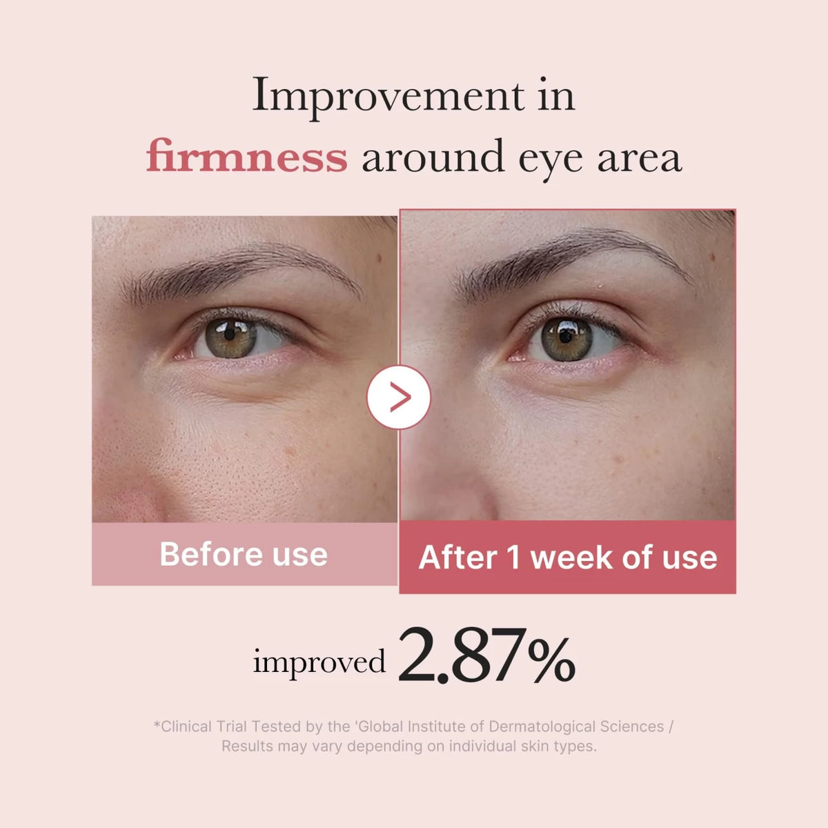 Medicube Pink Peptide Eye Serum for Fine Lines and Uneven Skin Tone 30ml