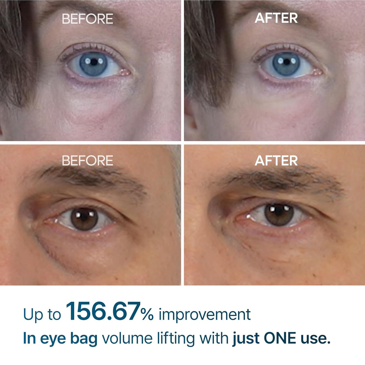 Dr. Melaxin Eyephalt Eyebag Tightening Cream (10ml)